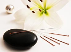 Acupuncture